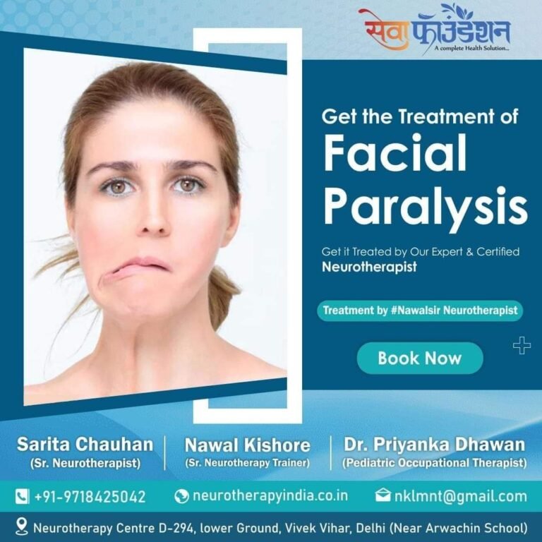 facialpalsy #bellpalsy