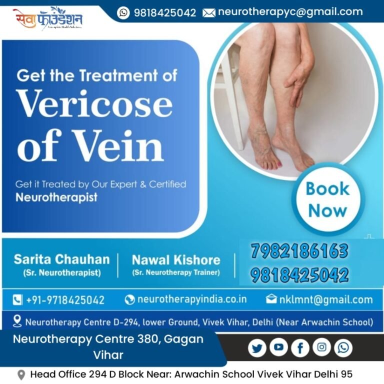 Varicose Of Veins Problem Treatment Centre