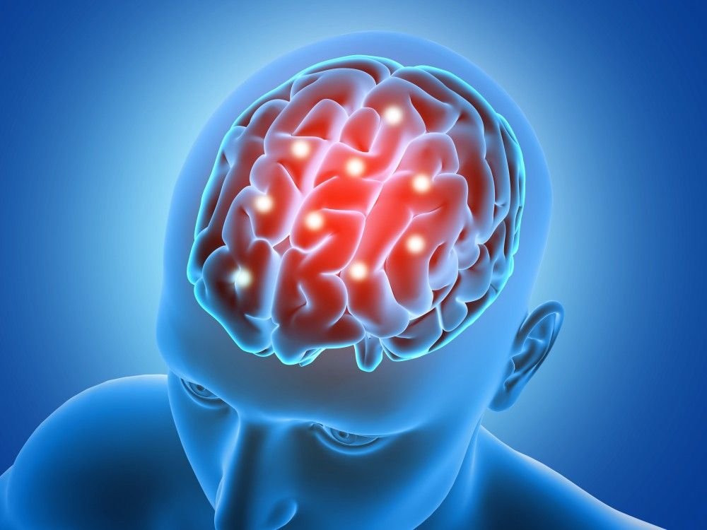 Best Neurotherapy Treatment in Vivek Vihar