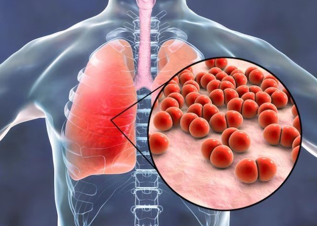 Best Bronchitis Treatment in Vivek Vihar