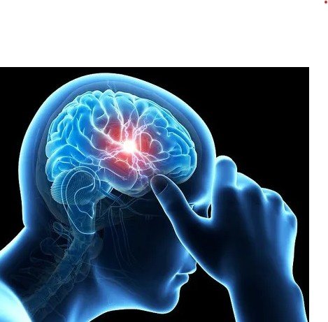 Best Neurotherapy for Migraine in Ahmedabad