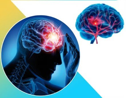 Best Neurotherapist for Migraine in Delhi NCR