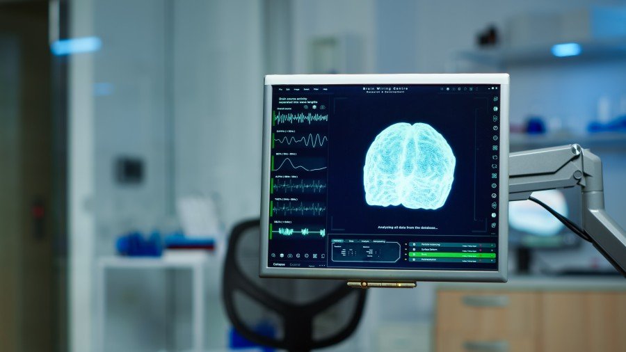 Brain scan displayed on a monitor during neurological research