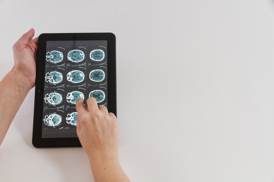 Neurotherapy Treatment displayed on a tablet showing brain scan images