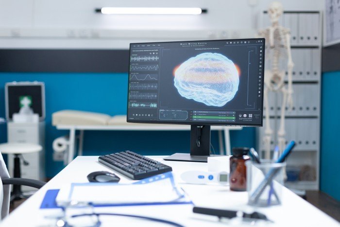 Neurotheripst workspace featuring a computer displaying a digital brain scan in a modern medical examination room