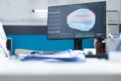 Neurotheripst analyzing a brain scan displayed on a medical monitor in a modern hospital examination room