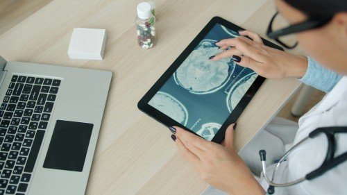 Neurotherapy specialist examining brain MRI scans on a tablet in a clinical setting.